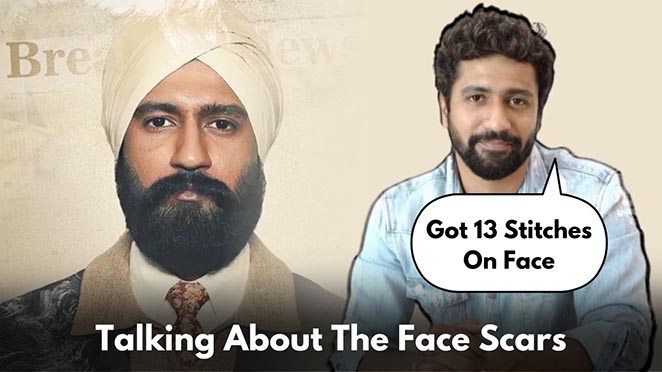 The Scars On Vicky Kaushal's Face In Sardar Udham Singh's Trailer Are Real, He Got 13 Stitches Due To An Injury