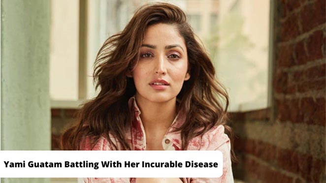 Yami Gautam Battling With Her Incurable Disease, Says ‘Finally Found Way To Confess It’