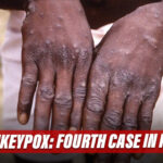 Amidst Covid Pandemic, Now Monkeypox Spread In A Matter Of Concern In India
